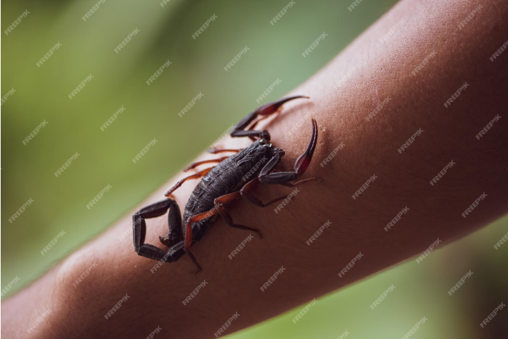 scorpion sting