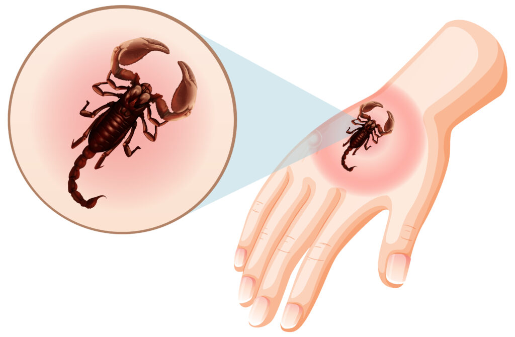 Scorpion Bites